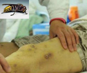 china hornets attack 41 killed