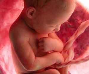 Doctors perform heart surgery on 25-week-old foetus