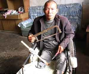 Chinese man hacks off his own infected leg