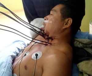 Builder survives 