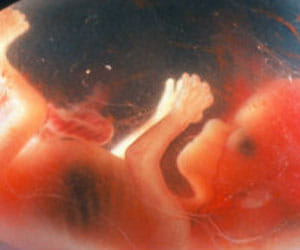 6 Months Foetus found in Garbage