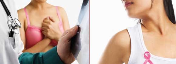 fatty diet risk breast cancer women
