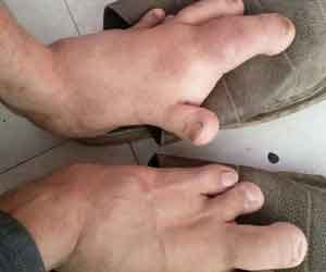 Man with enormous FEET finally finds pair of shoes 