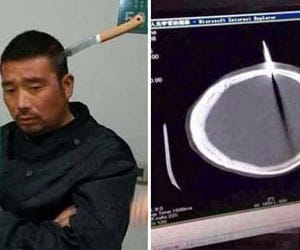 X-ray is free in district hospital