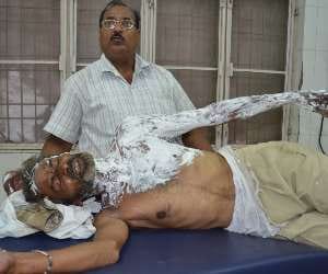 frustrated retired teacher set self ablaze