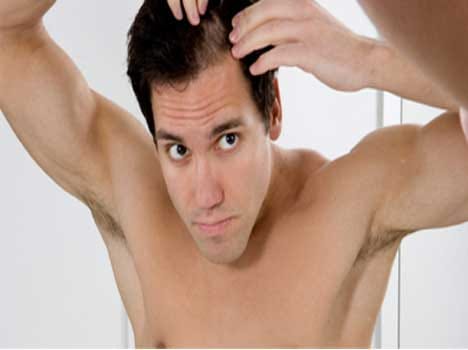 diet baldness hair loss