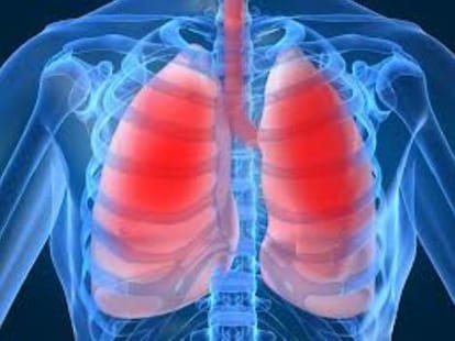 obesity rises risk of lung disease