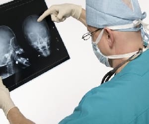 no neurosurgeon in doon hospital