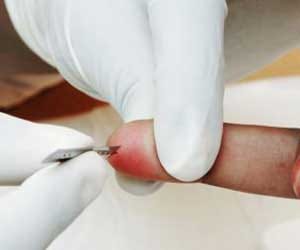 free education to HIV victims in himachal.