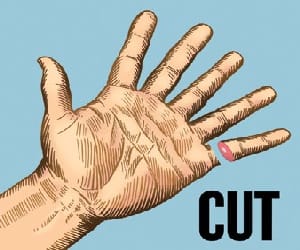 A workshop employee lost his four fingers under press machine