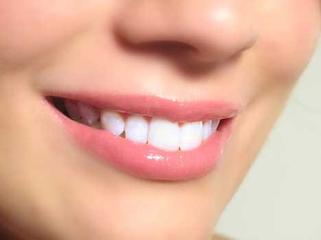 harmful diet for teeth whitening