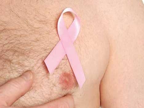 breast cancer risk increasing in men