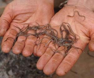 eels enters man body