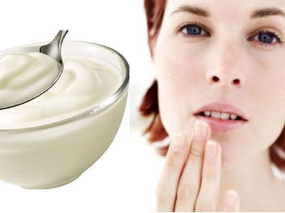 home remedies for chapped lips in winter