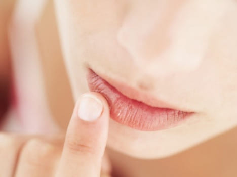 home remedies for chapped lips in winter