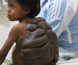 Unbelievable Birthmarks