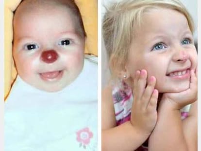 Unbelievable Birthmarks