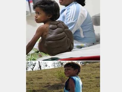 Unbelievable Birthmarks