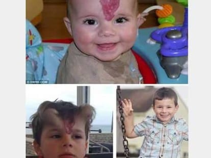 Unbelievable Birthmarks