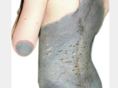 Unbelievable Birthmarks