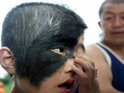 Unbelievable Birthmarks