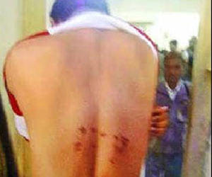 jailer beats inmate in dasna jail