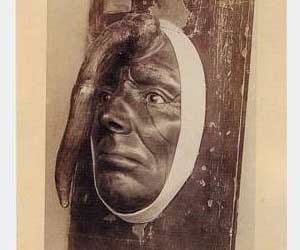 Bizarre and Shocking Medical condition