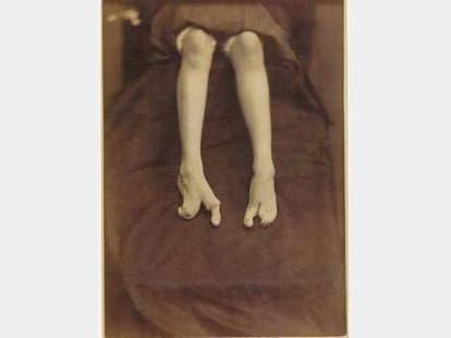 Bizarre and Shocking Medical condition