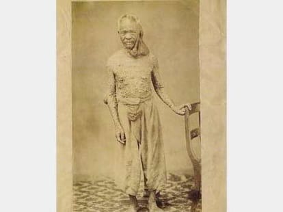 Bizarre and Shocking Medical condition