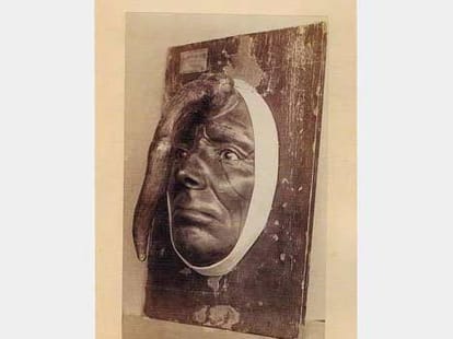 Bizarre and Shocking Medical condition