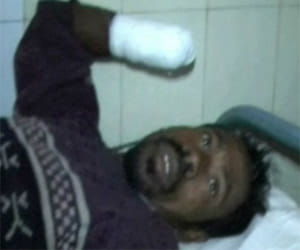 hands of two labourers hand chopped in orissa