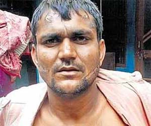 RTI activist burnt with cigarette in uttar pradesh