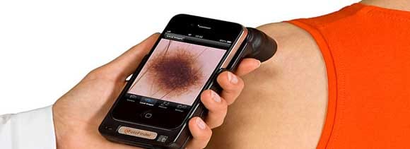 mobile app that can detect cancer
