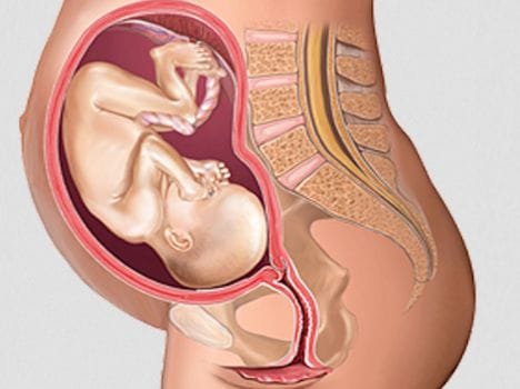 Women and treatment of Uterus