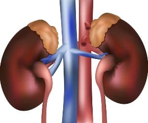 kgmu doctors saved the kidney patients life