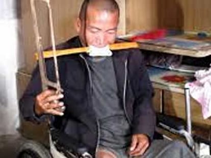 man cut off his leg