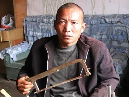 man cut off his leg
