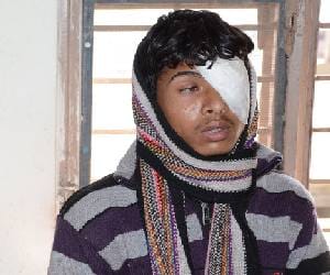 Safe Treatment Technique of Injured Eye