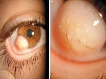 5 bizzare eye 