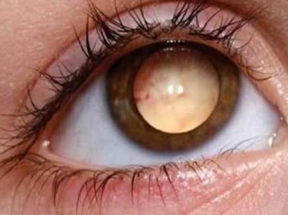 5 bizzare eye 