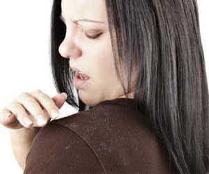 Medical Student Research to Find Out Hair Dandruf Insect