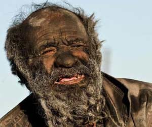 80-Yr-Old Man Has Not Taken Bath For 60 Years