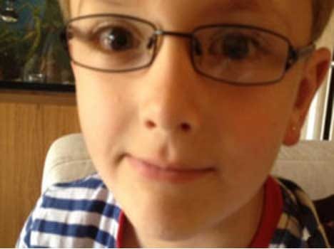 rare eye disorder found
