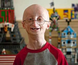 Boy Who Fought 'Aging Disease' Dead at 17