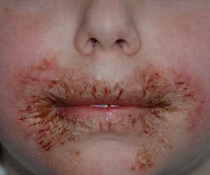 Chemical in baby wipes 