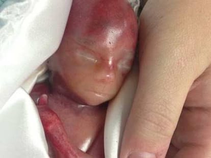 Mother shares heartbreaking photos