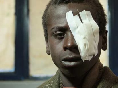 village_half_people_blindness