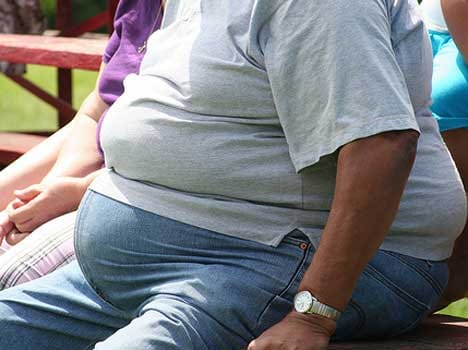 obese are more trigger to air born disease