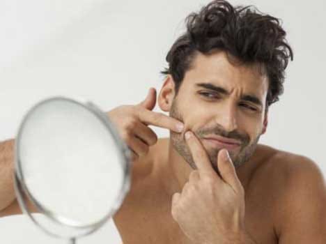 homemade acne face mask for men