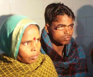 bihar acid attack followup